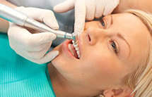 Лечение Зубного камня 