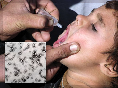 poliomielit