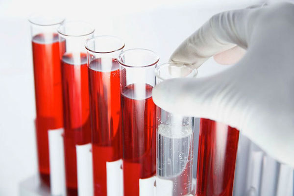 Анализ крови на гормоны и инфекции