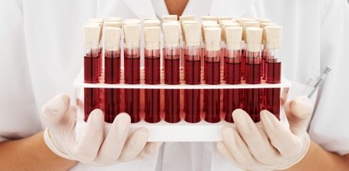 Анализ крови лабораторный