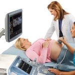 УЗИ с доплером при беременности