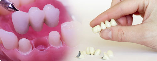 adentija-vrozhdennoe-otsutstvie-zuba-6
