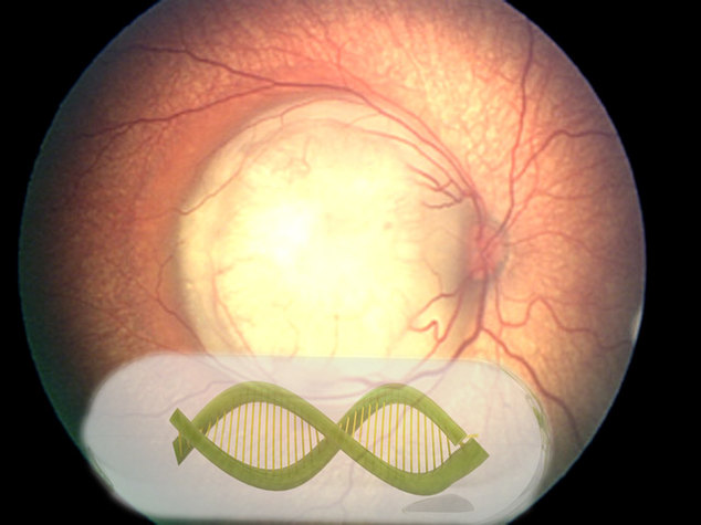 retinoblastoma-geneteraphy